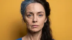 Ako získať späť pevnú pokožku?