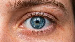 Ako zdvihnúť previsnuté viečko? 3 hlavné príčiny a metódy korekcie