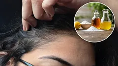 Aké sú výhody použitia octu a jedlej sódy na odstránenie šedín a ako to správne robiť?